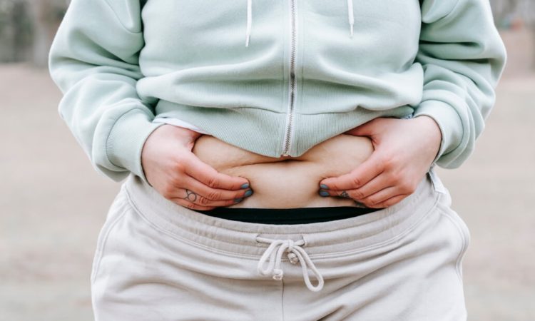 Obesity-Related Conditions Weight Loss Surgery